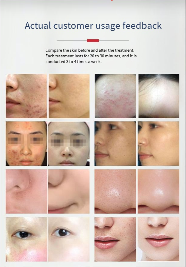 LED Beauty Mask Seven Colors